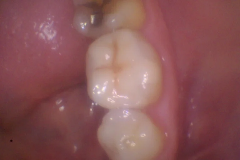 Escalante-Anthony-03_20_2025-2D-Oral_Facial-Photo-Images-1