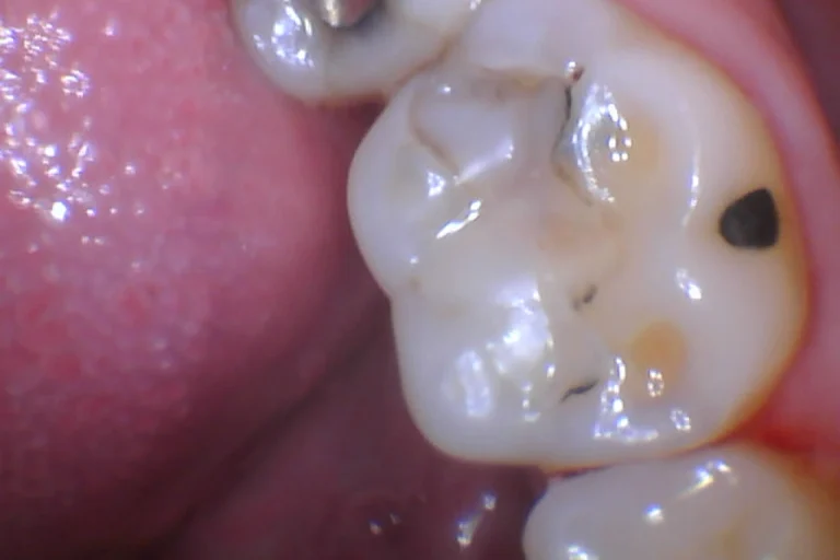 Escalante-Anthony-06_26_2024-2D-Oral_Facial-Photo-Images